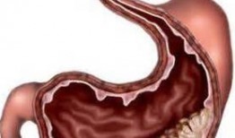 縻烂性胃炎可以吃老鼠瓜,老鼠瓜助力康复之旅